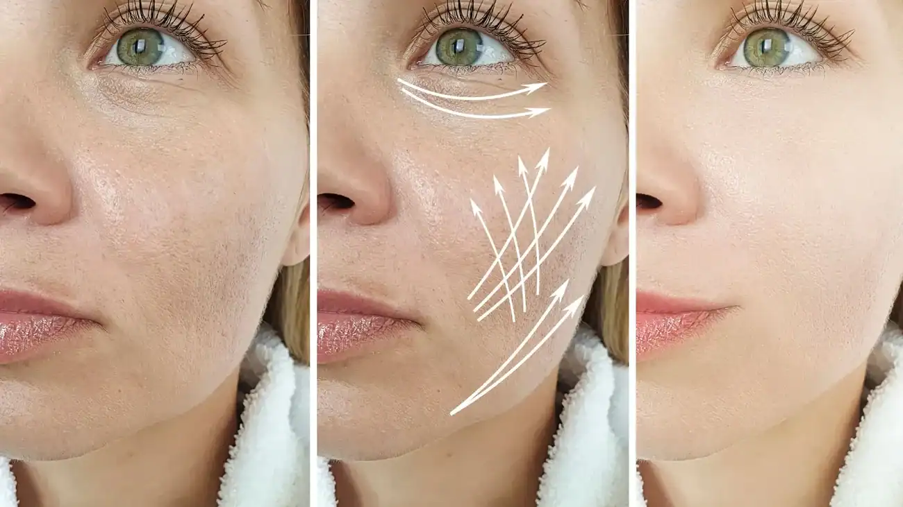 Can One Treatment Really Tackle More Than One Skin Concern Berkshire?