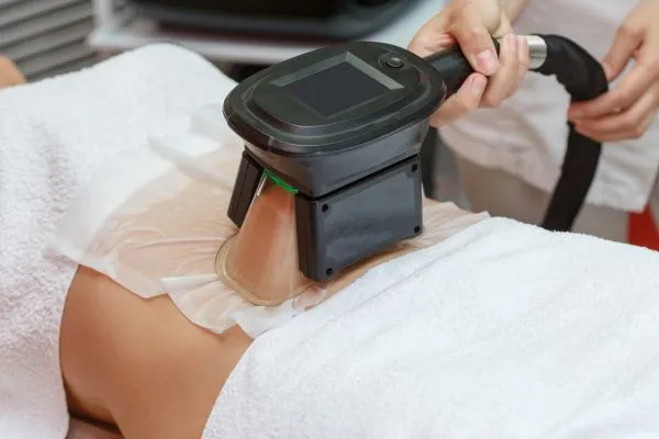 Image of person having fat freezing treatment to help weight gain Berkshire
