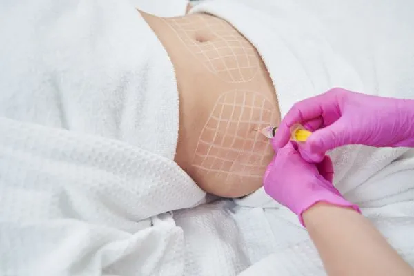 image of fat dissolving injections on love handles to help combat weight gain Berkshire