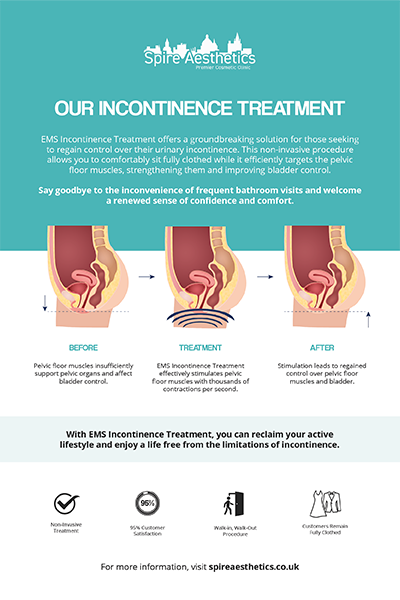 image to show how EMS treatment works for female urinary incontinence Berkshire