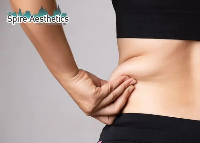 Image of woman pinching fat on their hips Berkshire. Fat Freezing treatment