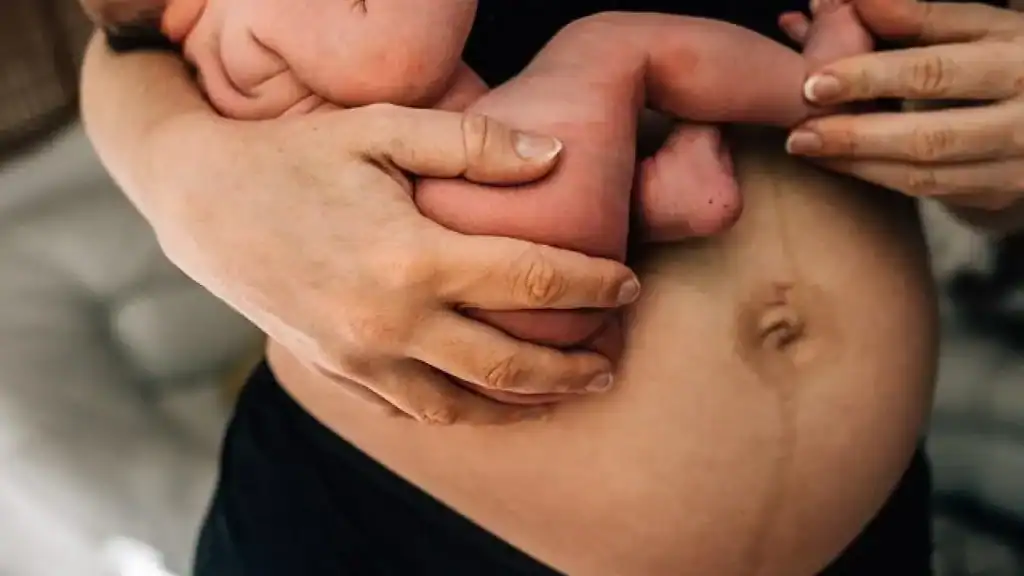 Why Is My Stomach Still Big After Pregnancy Berkshire?